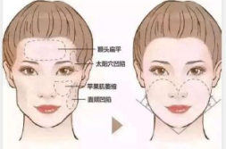 私密填充以后没有感觉,如何重拾愉悦体验