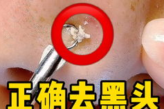 私密超生刀好不好,革新私密整形,效果如何?揭秘真实评价