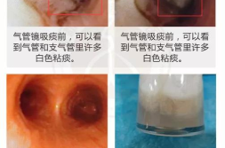一激动下面就流透明液体怎么办,应对性兴奋时分泌透明液体的实用指南