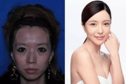 济南私密整形照片价格,揭秘美丽投资背后的真相